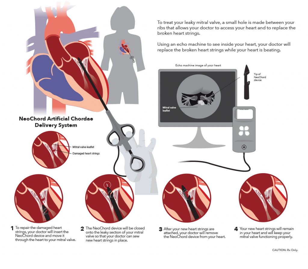 NeoChord_Illustration re10 NeoChord